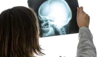 ⚕️Immunalgia Therapeutics desarrolló componente contra el dolor crónico