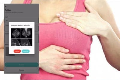 ⚕️Oncoguard busca prevenir el cáncer de mama