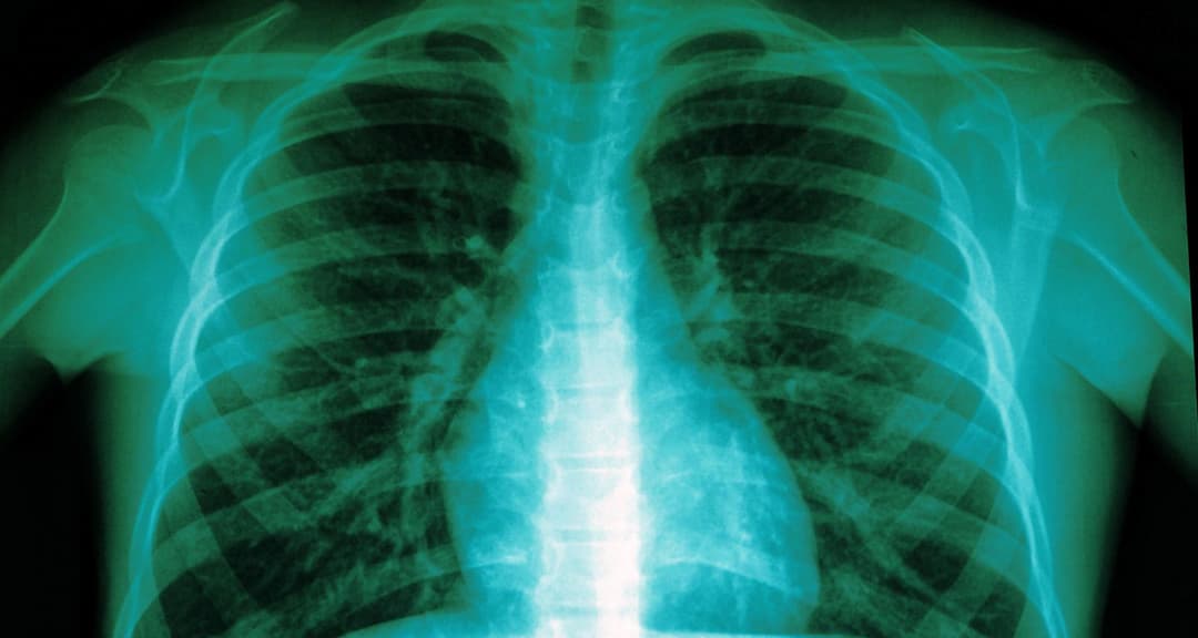 🚀 🩺 Eden presenta Eden AI Report para agilizar diagnósticos de radiografías